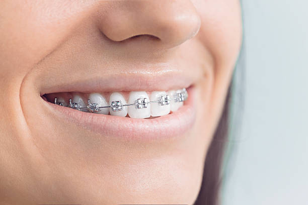 Dental Inlays and Onlays in Mayville, WI